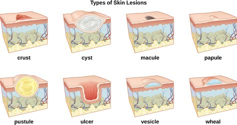 21.1: Anatomia e microbiota normal da pele e dos olhos.